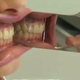 Illustration for article titled Steps Followed For The Best Orthodontic treatment Process At Growing Smiles